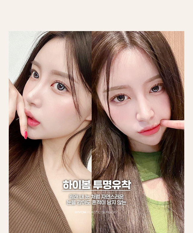 투명유착